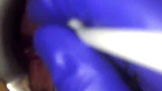 Extreme Cervix Play During Intense Gyno Exam Session