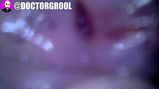 doctor inspects creamy vagina with endoscope video