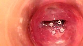 摄像头深入阴道获取原始视图