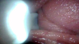endoscope camera shows penis sensitive parts educational video