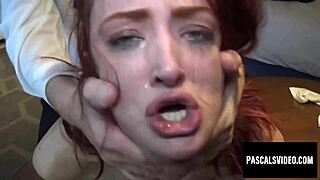 Naughty Redhead Andi Rye Visits Pascal White For Vaginal Restructuring