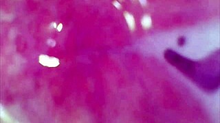 real pussy orgasm contraction cam inside pussy sperm found in pussy juice under microscope