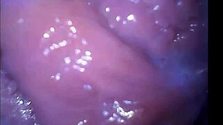 girl squirts hard while filmed from deep inside her vagina at secretfriends