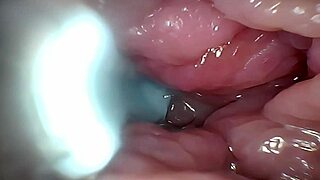 gaping german wife pussy stretched wide semen cervix endoscope