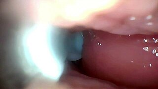 gaping german wife pussy stretched wide semen cervix endoscope