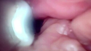 gaping german wife pussy stretched wide semen cervix endoscope