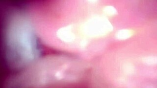 gaping german wife pussy stretched wide semen cervix endoscope