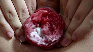 two sluts threesome anal wreck asses with gapes prolapse atm squirts
